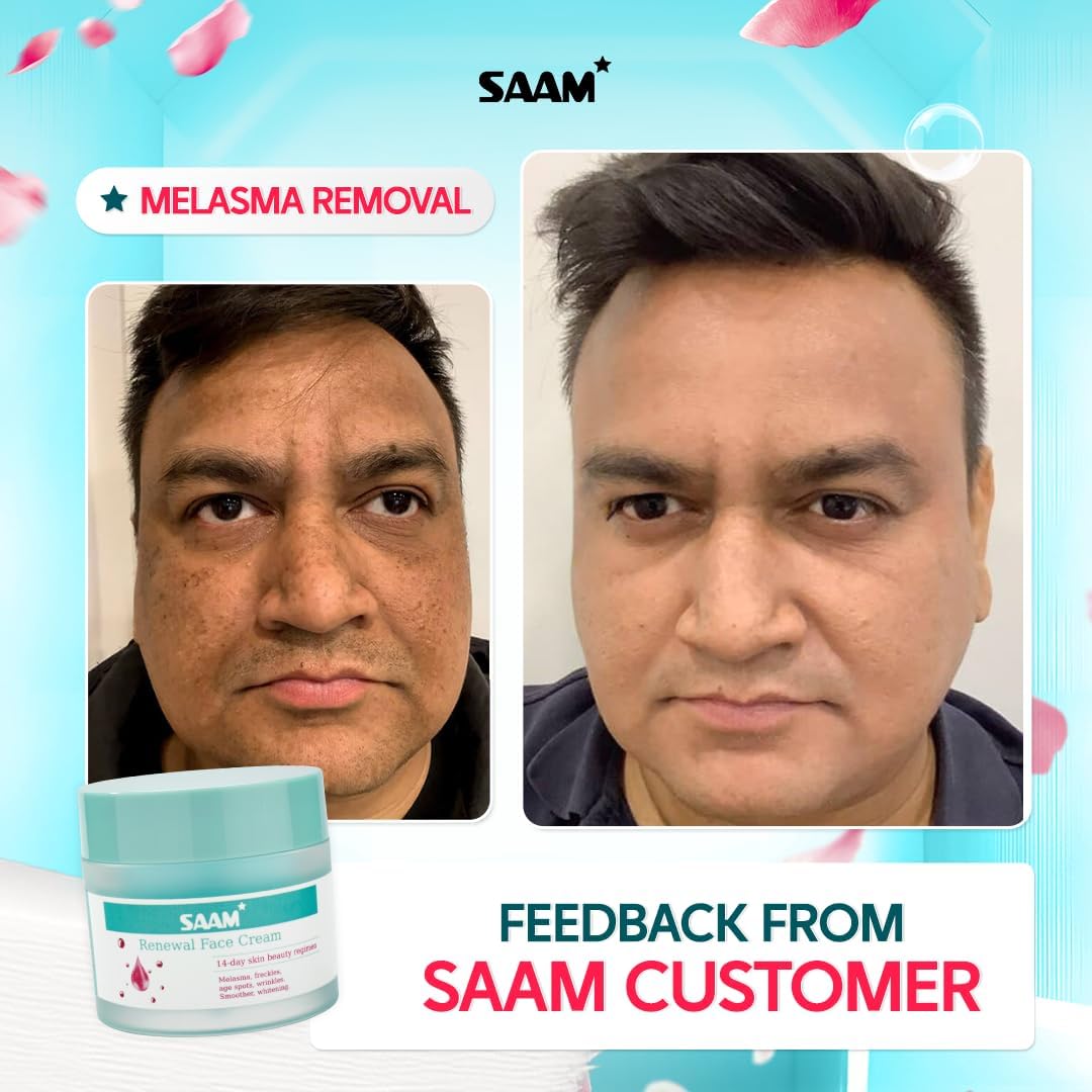 SAAM Renewal Face Cream – 50g
